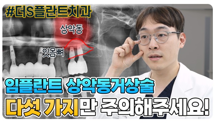 상악동거상술 후 주의사항 | 조홍재TV 영상 썸네일